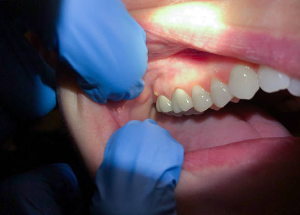 Best Emergency Denture Repair in Jennerstown, PA
