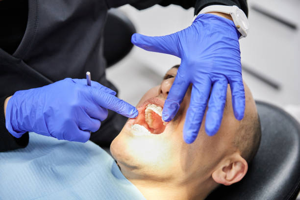Best Emergency Treatment for Dental Infections or Abscesses in Jennerstown, PA